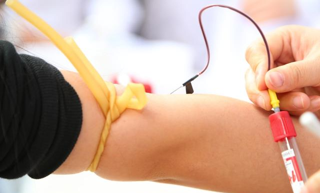 HCG下降多少表示胎停 怀孕期间hcg值低必须流产吗 HCG下降多少表示胎停 怀孕期间hcg值低必须流产吗